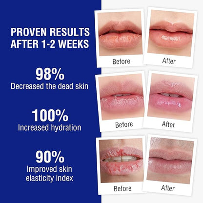 Lip Balm Treatment with Beeswax, Peppermint Chapping