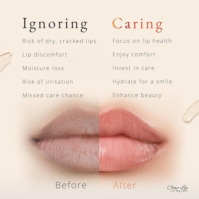 CHAP-LIP Original Lip Balm Hydrating Bulk Gift