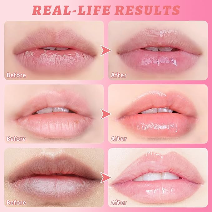 3 Pcs Honey Lip Balm, Bee (Honey+Strawberry+Watermelon)