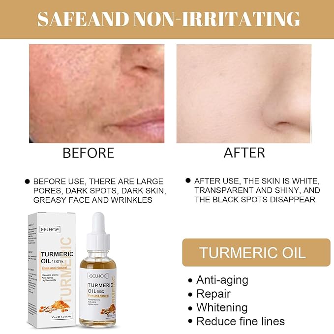 3PCS Turmeric Dark Spot Corrector Serum Oil,Turmeric Repair Face Serum, Natural Turmeric Skin Dark Spot Skin Care Moisturizing Repair Serum,Turmeric Serum for Face & Body(30ml)