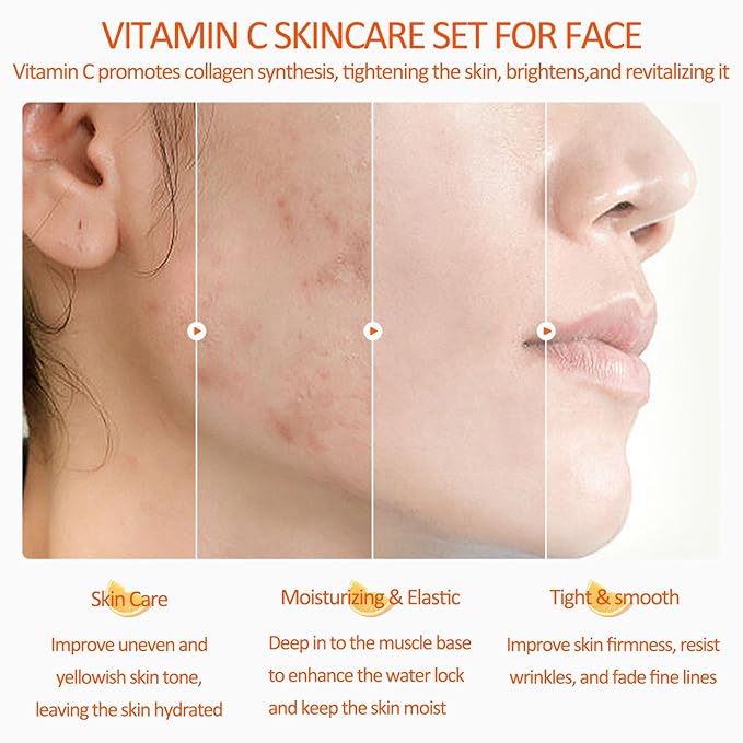 8-Pack Vitamin C Skin Care Kit, Vitamin C Complete Skin Care Set, Routine Skincare Set With Face Wash, Toner, Face Serum, Face Cream, Eye Cream, Face Mask & Lip Balm, Skincare Gift Set For Women