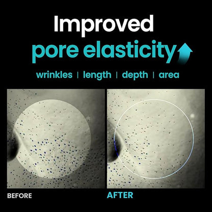 ILSO ER Firming Serum - Retinol 0.1% + Ectoin 1%, Anti-aging & Wrinkle Reducing, Gentle for Sensitive Skin (30ml)