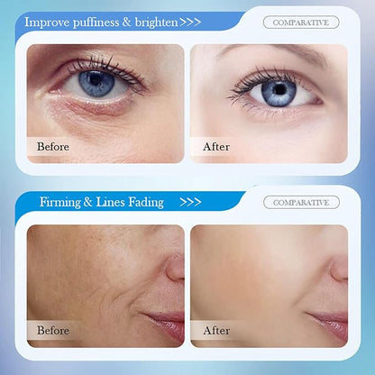 8D Hyaluronic Acid Face Care Set, Hydrating