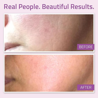 YEOUTH Anti Aging Serum for Face with Hyaluronic Acid, Ferulic Acid, Vitamin C and E, Hydrating Face Serum for Women and Men Targets Dull and Dry Skin 1oz