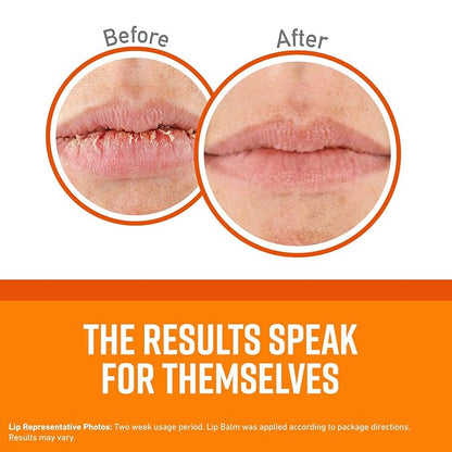 O'Keeffe's Unscented Lip Repair Lip Balm