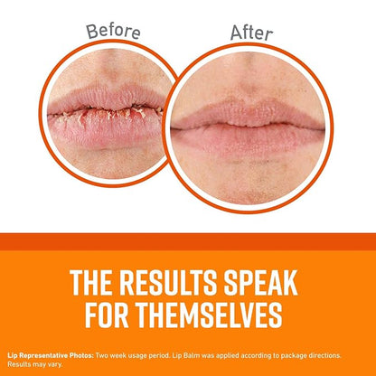 O'Keeffe's Unscented Lip Repair Lip Balm Lips,