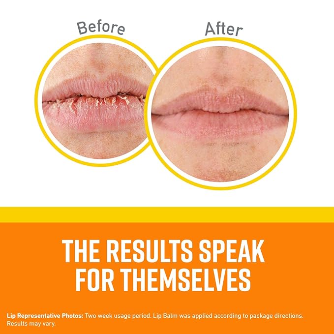 O'Keeffe's Lip Repair SPF 35 Lip