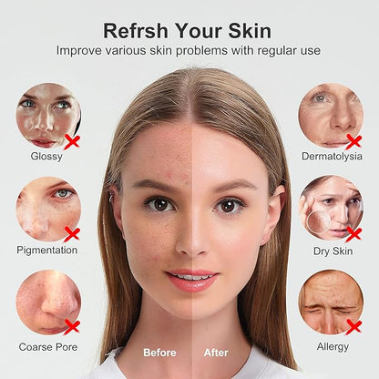 Newbealer Facial Steamer, Mini Aroma Face Steamer, Nano Ionic Hot Mist Face Humidifier for Facial Deep Cleaning, Home Sauna Spa Sprayer with 9 Pieces Acne Remover Kit (Blue, 160 ml)