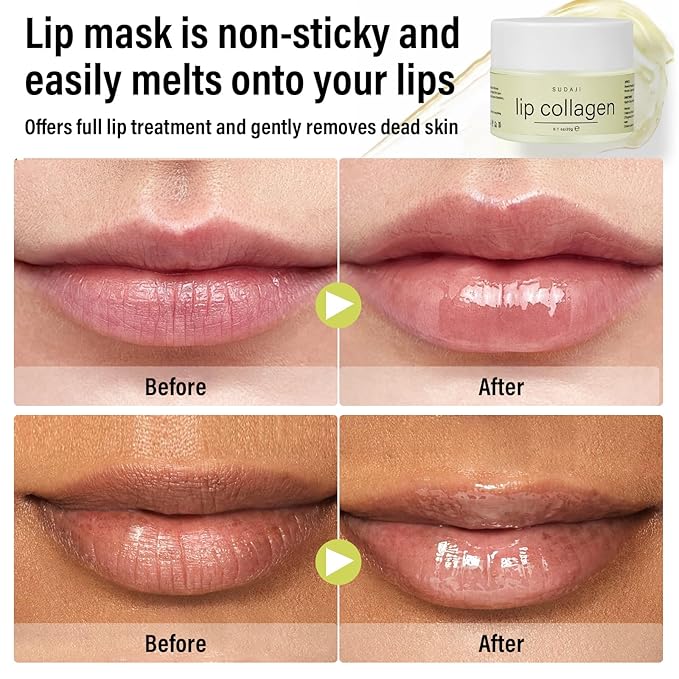 Lip Collagen + Peptide Complex, Collagen