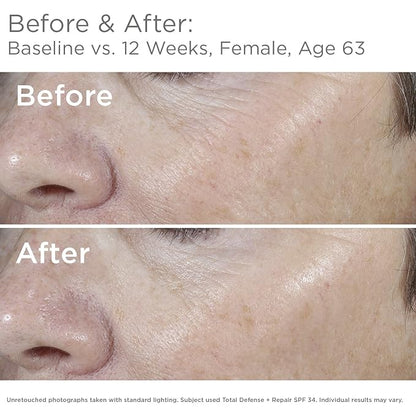 SkinMedica Total Defense + Repair SPF 34 Sunscreen for Face. This Lightweight, Facial Sunscreen is Ideal for Oily and/or Combination Skin, 2.3 Oz