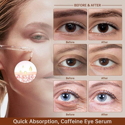 Caffeine Solution 5% + EGCG For Dark Circles & Puffiness, 30ML Anti Aging Under Eye Serum For Eye Bags, Fine Lines, Moisturizing Caffeine Solution.