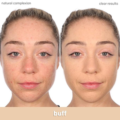 Almay Clear Complexion Acne Foundation Makeup with Salicylic fl oz.