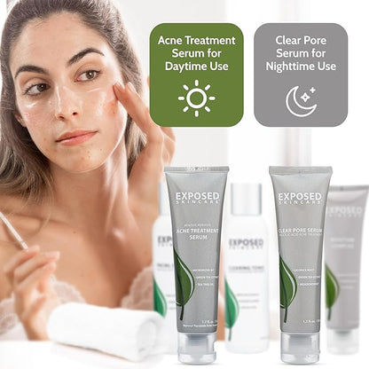 Exposed Skin Care Expanded Acne Treatment Clearing