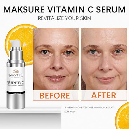 Super C Serum for Mature Skin, All-in-One Vitamin Formula Hydrates, Dark Spot Serum, Hydrates, Firms, Lifts, Smooths, Wrinkles, Reduce Dark Spots, Targets Age Spots & Wrinkles, 1 fl oz