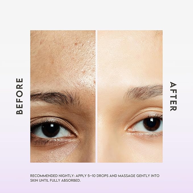 Advanced Night Serum – 1% Squalane for Deep Hydration & Skin Repair, Overnight Recovery for Fine Lines & Dryness, Lightweight, Fast-Absorbing Formula - 1 oz