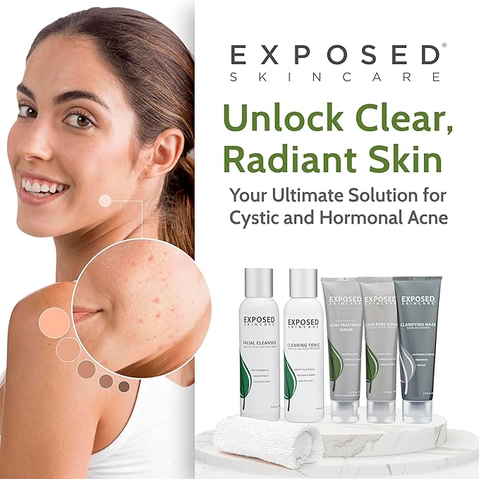 Exposed Skin Care Acne Treatment Kit Clearing