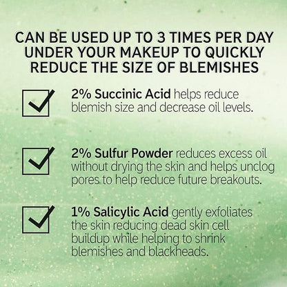 The INKEY List Succinic Acid Treatment 15ml, Clears Blemishes, Acne Treatment, Vegan Friendly, Suitable For All Skin Types
