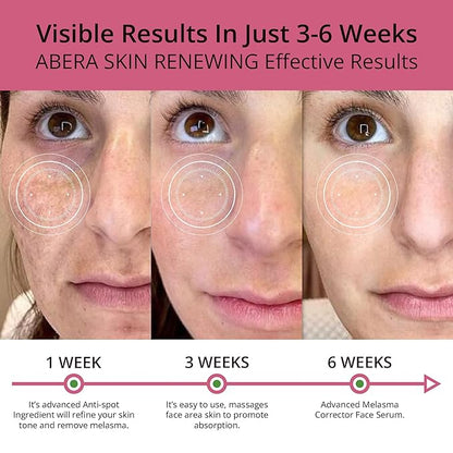 Combo Abera Saffron Serum For Melasma Treatment & Abera Eye Roller Serum With Mint For Dark Circles and Puffiness