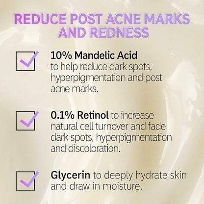 The INKEY List Mandelic Acid Treatment, .5 fl oz