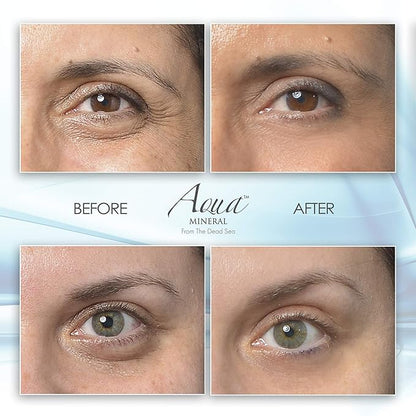 Puffy eye gel instant results
