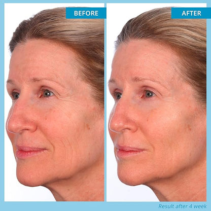 SKINN Deep Wrinkle Facial Serum, Intensive Age Reset Serum - Anti Wrinkle Repair Face Serum - Hydrating & Plumping Anti Aging Serum Reduces Fine Lines - Ferulic Acid, Retinol & Vitamin C