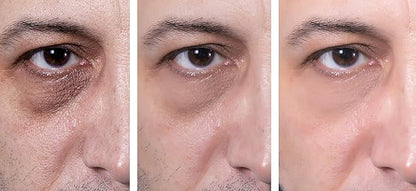 Eye Gel, for Dark Circles, Puffiness, Wrinkles, Skin Firming and Bags - Effective Anti-Aging Eye Gel for Under and Around Eyes including Crows Feet with Hyaluronic Acid and Aloe Vera- 1.7 fl. oz.