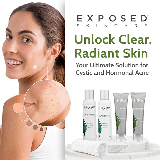 Exposed Skin Care Basic Acne Treatment Clearing