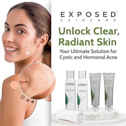 Exposed Skin Care Basic Acne Treatment Clearing