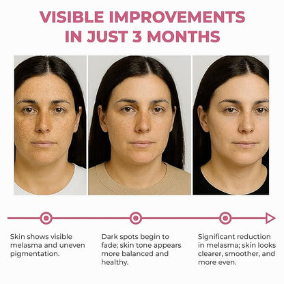 ABERA Skin Renewing Serum For Melasma Treatment, High-Potency Saffron Extract + Gift Curcumin Face Cleanser with Turmeric, Face Wash to Reduce Sebum (3 Boxes + Gift)