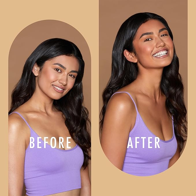 St. Moriz Advanced Self Tanner Face Mist, Sunless Tanning Spray (Medium, 5.07 Fl Oz) - Quick Tan Clear Bronzing Spray with Aloe Vera & Vitamin E – Gradual Self Tan for Face - Fake Tan Spray