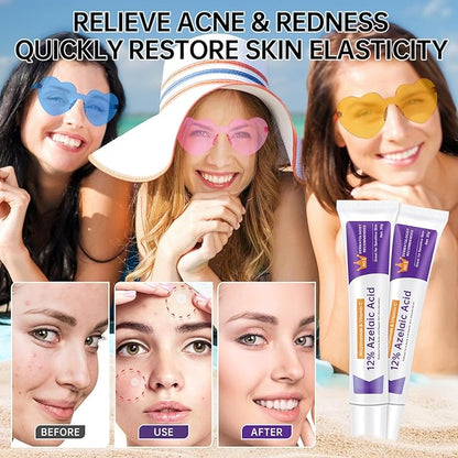 Azelaic Acid 12% Cream For Face, Azelaic Acid Acne Cream For Rosacea Treatment, Redness Relief, 0.7 OZ Azelaic Acid Gel With Salicylic Acid & Niacinamide For Dark Spot, Skin Care.