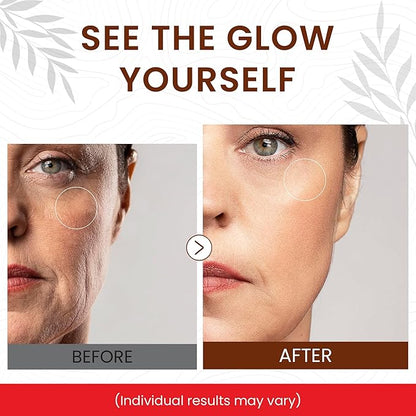 Live Healthy Super Vitamin C Serum for Women Over 70 - C Super Serum, Vitamin C, Peptides, Vitamin E - Rapid Anti Aging, Lifting & Firming, Anti Wrinkle & Age Spots Reduction - Made in USA | 30ml