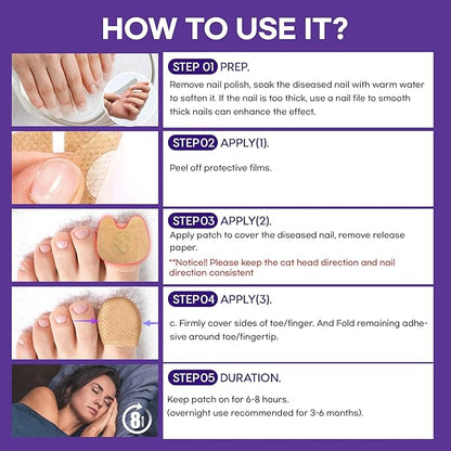 Extra Strength Toenail Fungus Treatment