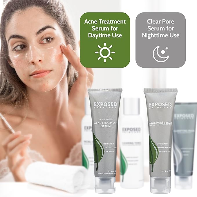 Exposed Skin Care Acne Treatment Kit Clearing
