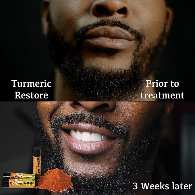 Turmeric Lip balm | Turmeric Restore Supplies