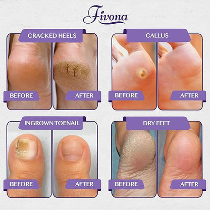 Fivona Foot Soak Blend Epsom Salt with Lavender 14.1 oz - Calming Foot Bath Salt, Relax & Renew Tired Feet, Soothe Soreness, Soften Calluses - Rejuvenating Pedicure Spa at Home