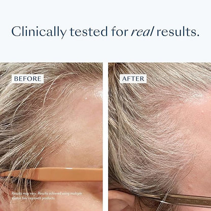 eSalon Biotin Hair Gummies, Vegan Multivitamin, Cherry & Citrus Flavor, 60 Count, 30 Day Supply