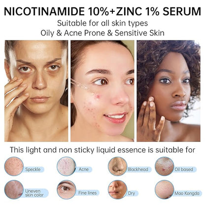 Niacinamide 10%+ Zinc 1% Serum For Face, Niacinamide Serum For Face, Dermatologist, Redness Relieve-30ml 1floz, 2Pcs