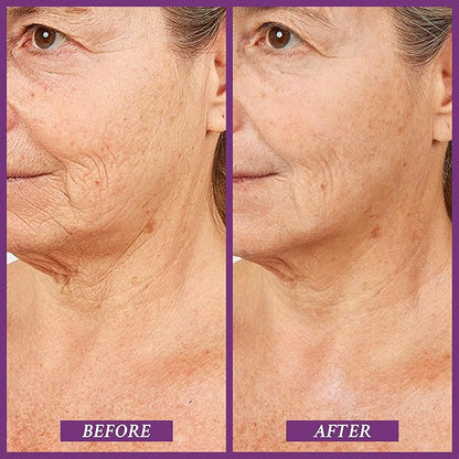 PRAI Beauty Ageless Throat & Decolletage Serum for Instantly Ageless Neck | Neck Firming and Tightening Serum | Anti-Aging Serum that Shields Skin from Damage and Improves Skin Tone + Colour | 4 Oz