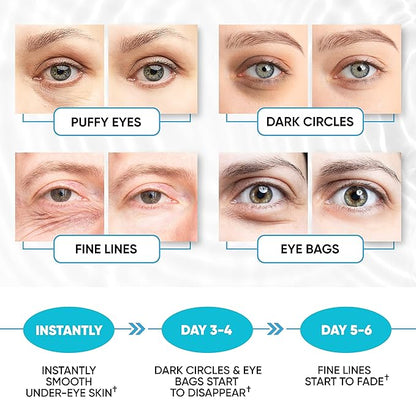 Under eye patches for puffy