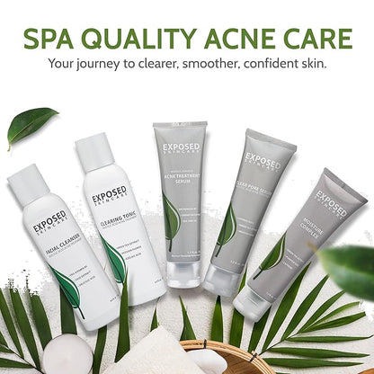 Exposed Skin Care Expanded Acne Treatment Clearing