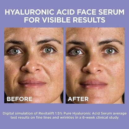 L'Oreal Paris Revitalift 1.5% Pure Hyaluronic Acid Face 1 kit 1.0 oz
