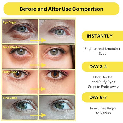 Under eye patches - 60