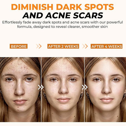 20% Vitamin C Serum 30ml - Maximum Strength Formula - Retinol, Hyaluronic Acid, Collagen - Treatment For Face & Eyes, Wrinkles