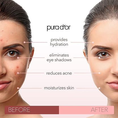 PURA D'OR 16 Oz ORGANIC Sweet Almond Oil - 100% Pure & Natural USDA Certified Cold Pressed Carrier Oil For DIY Beauty - Non-Greasy, Unscented, Hexane Free Moisturizer - Massage Oil For Hair & Skin