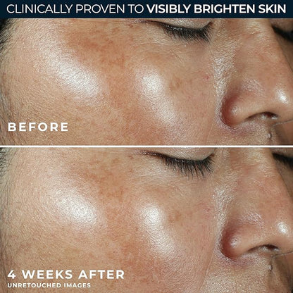 RoC Multi Correxion Revive + Glow Vitamin C Broad Spectrum SPF 30 Moisturizer (1.7 oz) with Retinol Eye Cream Packette